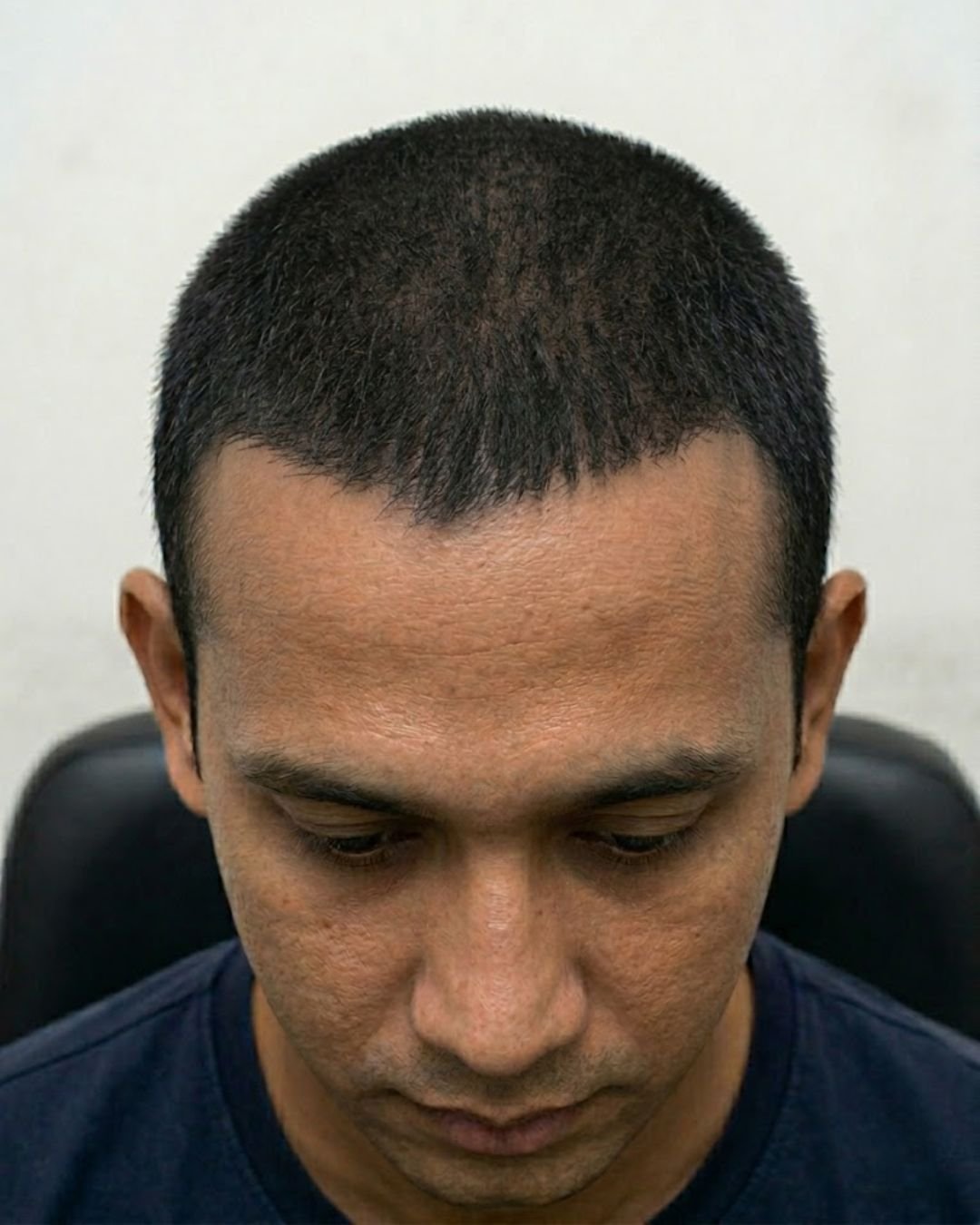After treatment